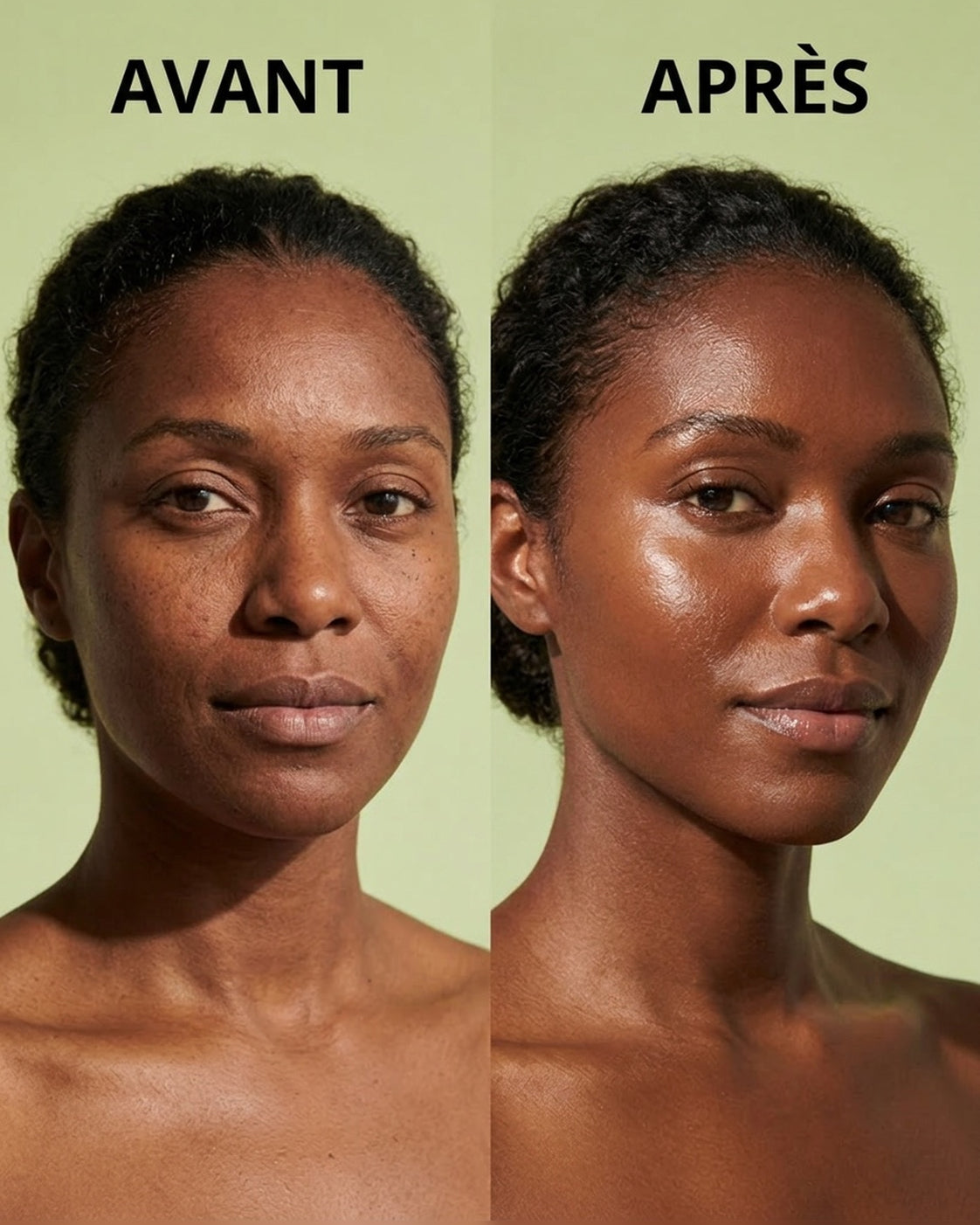 Dermelya - Retinal Shot Dermelya